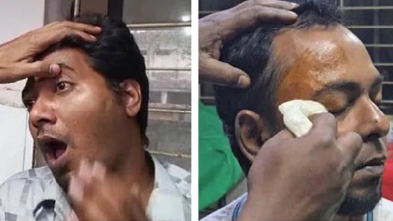 হামলার শিকার সাংবাদিককে ফোন তথ্যমন্ত্রীর, কঠোর বিচারের আশ্বাস