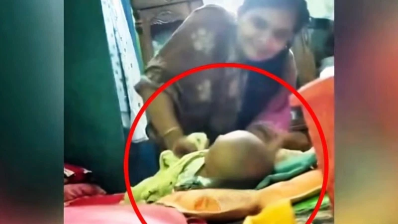 নরসিংদীতে তিন মাসের শিশুর পা ভেঙে দেওয়ার অভিযোগ, অভিযুক্ত আপন চাচি