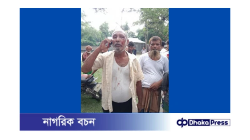 ফরম ফিলাপের টাকা ফেরত চাওয়াতে হামলার শিকার অভিভাবক 