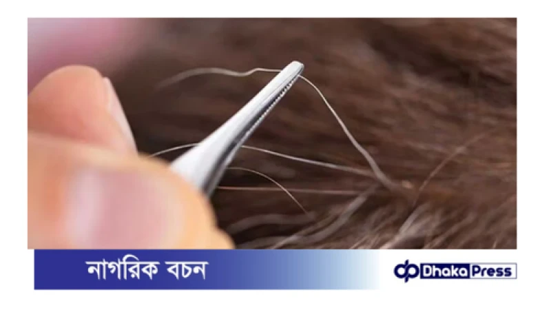 পাকা চুল তুললে কি আরো বেশি গজায়