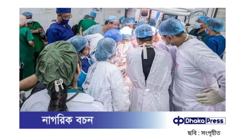৮০ চিকিৎসকের অসাধারণ প্রচেষ্টায় জোড়া লাগানো যমজ বোন আলাদা