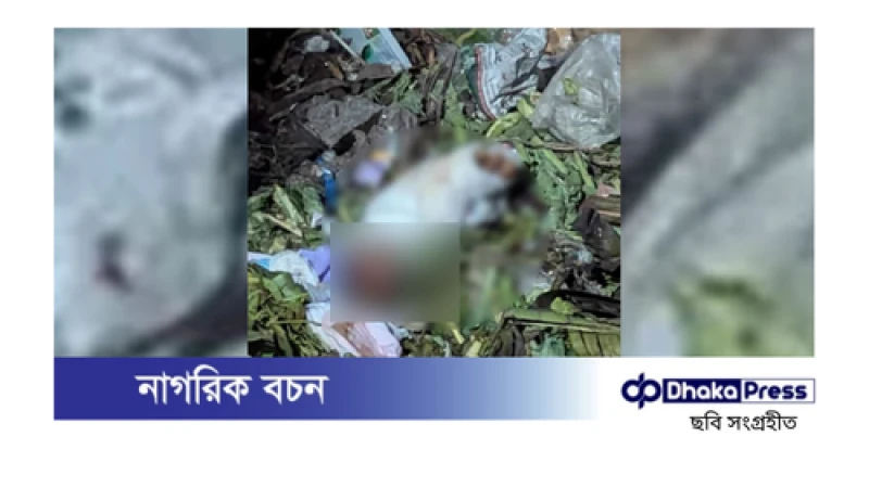 মোহাম্মদপুরে ডাস্টবিনে মানুষের খণ্ডিত পা উদ্ধার