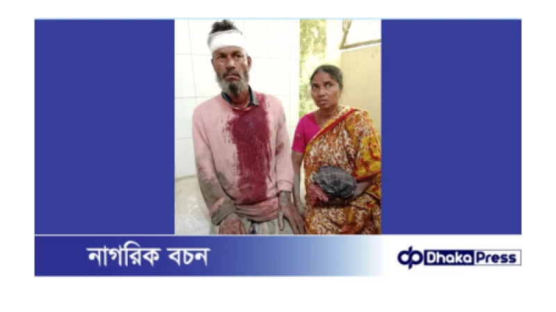 পলাশবাড়ীতে জমিতে সেচপাম্পের পানি সরবরাহকে কেন্দ্র করে মারপিটে আহত ৮