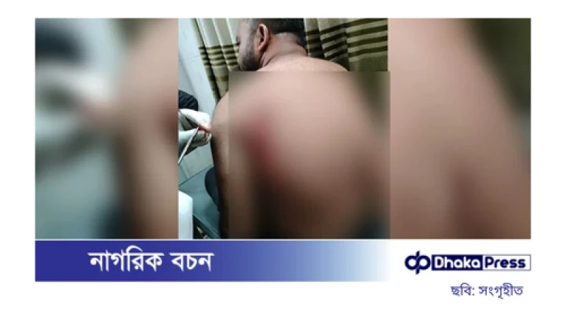 শহীদ মিনারে বিএনপির দুই পক্ষের সংঘর্ষে আহত ২