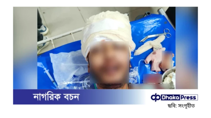 কক্সবাজার বিমান ঘাঁটিতে অতর্কিত হামলা, গুলিতে তরুণ নিহত