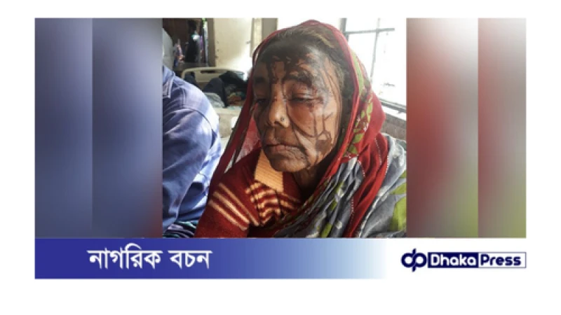 কুড়িগ্রামে বৃদ্ধাকে এসিড নিক্ষেপ, মামলা নেয়নি পুলিশ 