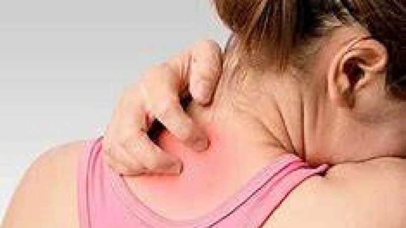 গরমে ঘামাচি থেকে মুক্তি