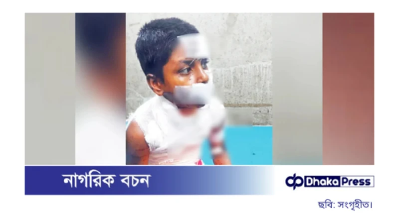 নির্মমতার শিকার শিশু রাব্বী: শরীরজুড়ে ব্লেডের আঘাত