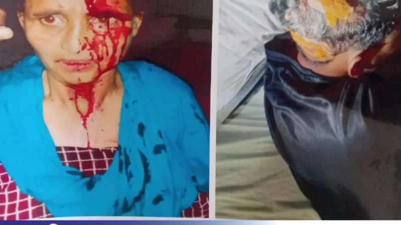 মাদারগঞ্জে  ছিনতাই-বিদেশি চাইনিজ  কুড়াল  দিয়ে মাথায় আঘাত।