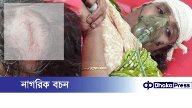 সোনারগাঁয়ে গনকবাড়ী এলাকায় জোরপূর্বক রাস্তা দখলকে কেন্দ্র করে মহিলাসহ আহত ৩, কুপিয়ে রক্তাক্ত জখম