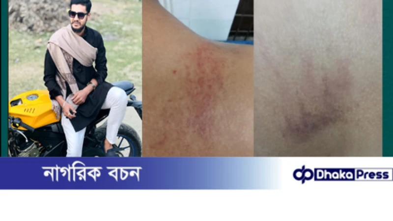 রাজারগাঁওয়ে যাত্রী ওঠানোকে কেন্দ্র করে রক্তক্ষয়ী হামলা, গুরুতর আহত যুবক