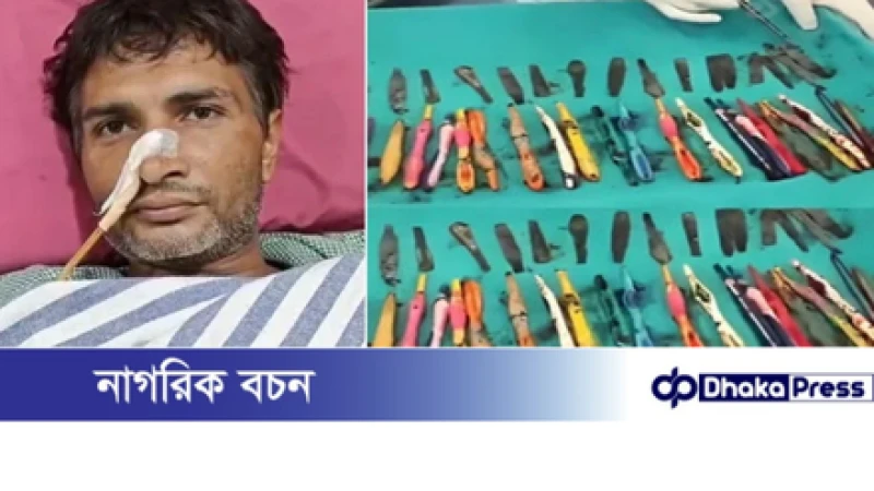 এক যুবকের পেট থেকে উদ্ধার হলো অদ্ভুত সামগ্রী