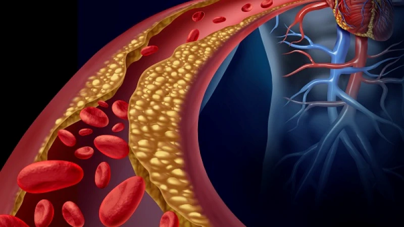 রক্তে কোলেস্টেরল বেড়ে যাওয়ার কারণ ও করণীয়