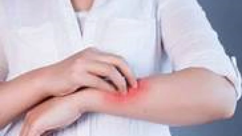 ফাঙ্গাল ইনফেকশন হলে করণীয়