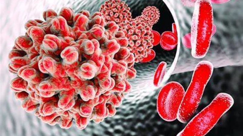 বর্ষায় হেপাটাইটিস-এ রোগের শঙ্কা