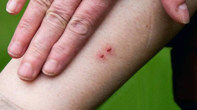 সাপে কামড়ালে করণীয় কি?