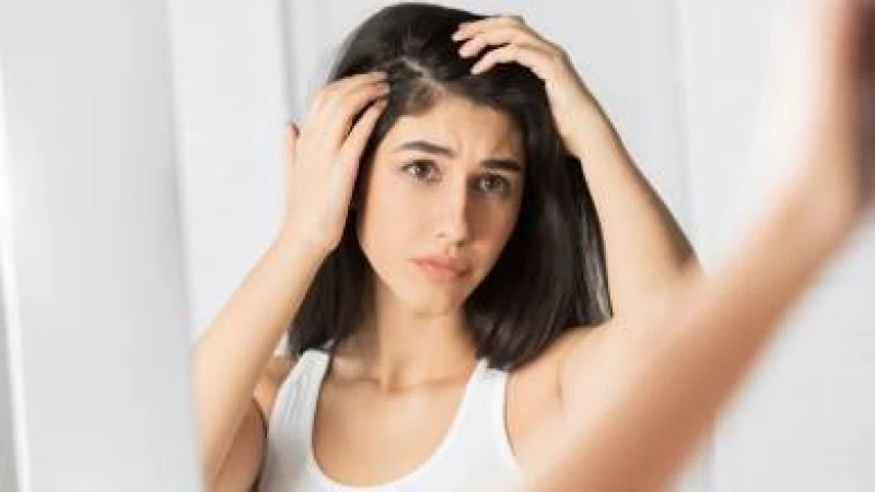 খুশকির সমস্যা থেকে মুক্তির উপায়