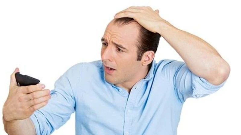 মাথায় টাক পড়লে করণীয়