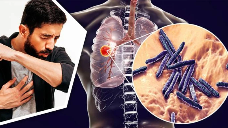 যক্ষ্মা কেবল ফুসফুসের ব্যাধি নয়