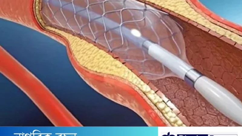 দেশে প্রথম বারের মতো হার্টে রিং পরালো রোবট।