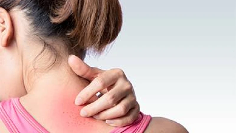 গরমে মুখের র‍্যাশ-চুলকানি