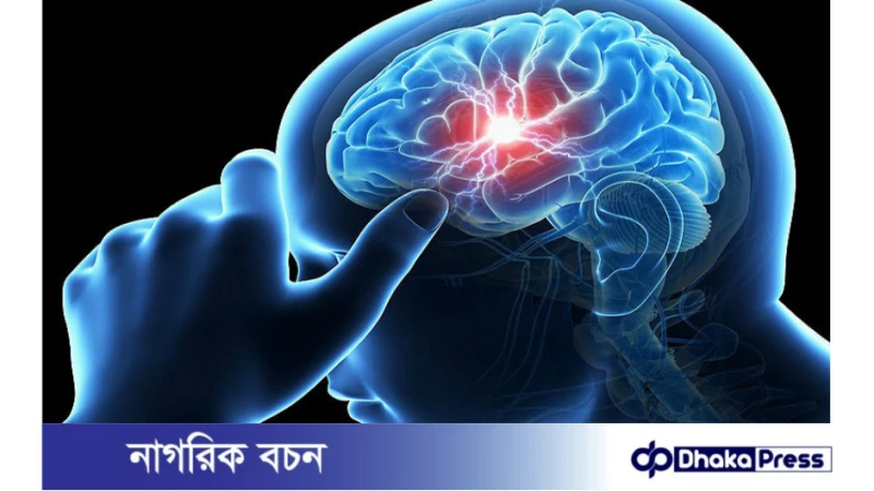 স্ট্রোক হওয়ার কারণ ও লক্ষণ