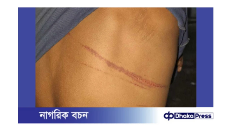 সান্তাহারে ঘর নির্মাণের বিষয় নিয়ে দুই ভাইকে মারপিট: থানায় অভিযোগ