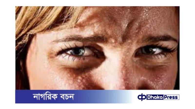 অতিরিক্ত ঘাম কখন রোগের লক্ষণ?