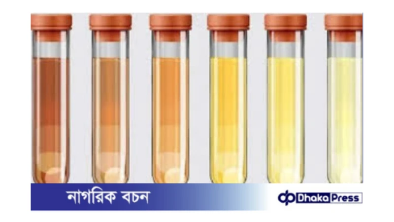 প্রস্রাবের রঙ বিভিন্ন কারণে পরিবর্তিত হতে পারে। কিছু কারণ সাধারণ এবং চিন্তার কোন কারণ নেই, আবার কিছু কারণ গুরুতর স্বাস্থ্য সমস্যার ইঙ্গিত দিতে পারে।