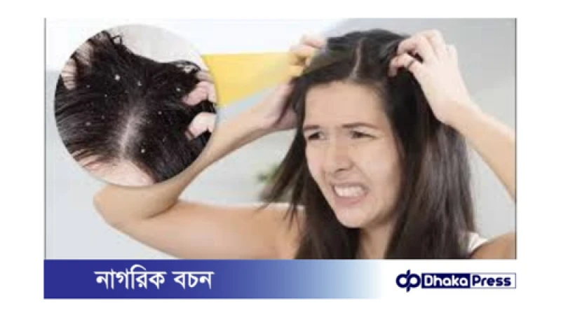 বর্ষায় মাথার ত্বকে চুলকানি: কারণ ও সমাধান